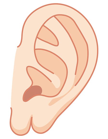 耳垂裂(じすいれつ)とは